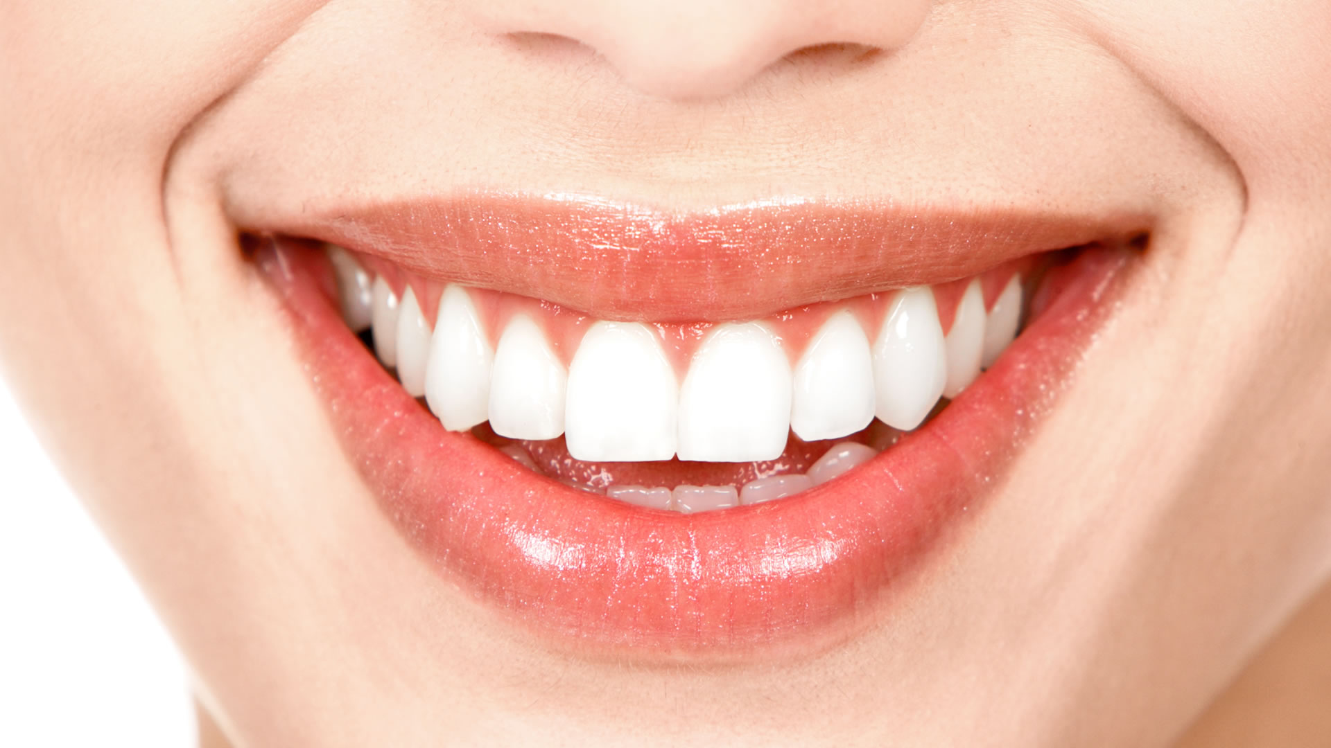 Diseño de Sonrisa