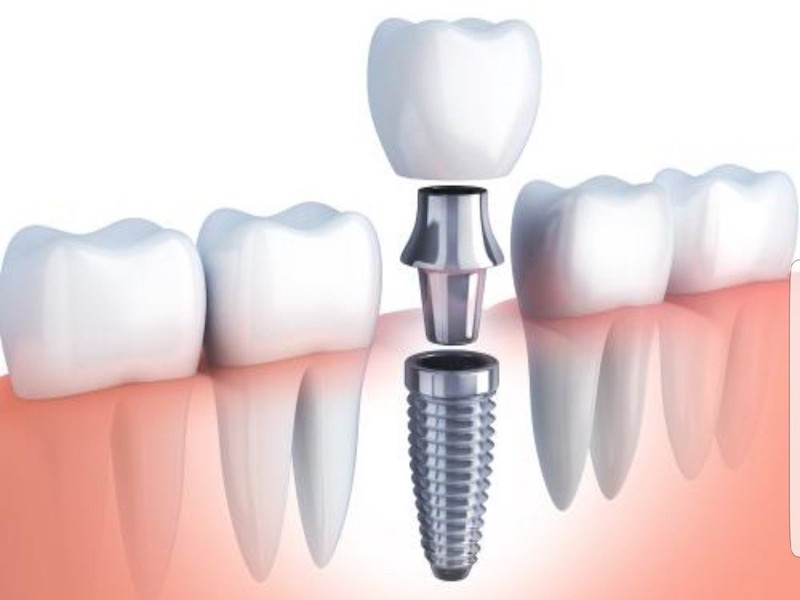 Prótesis y Rehabilitación Oral